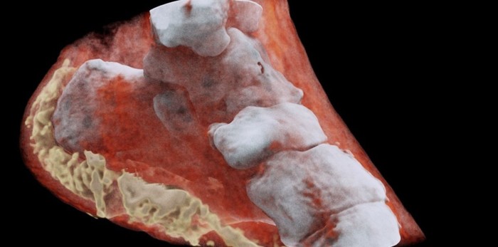 3D-рентген раскрывает секреты из костей