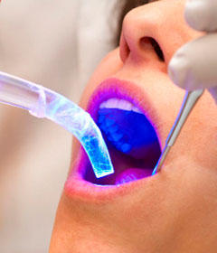 Читать новость Чем интересна ультразвуковая чистка зубов