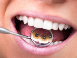 Читать новость Как найти опытного ортодонта в Уфе